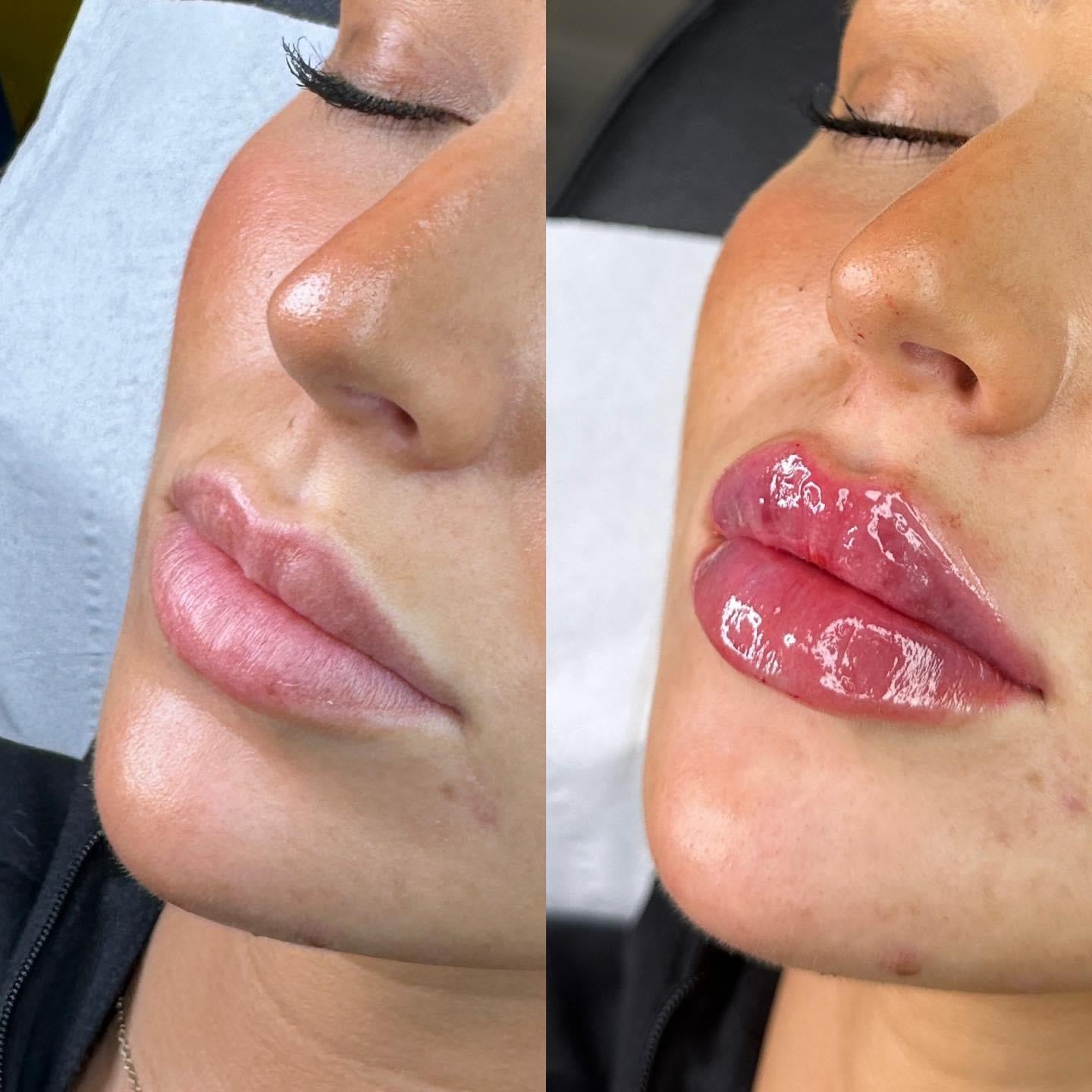 Ultimate Lips Masterclass - (Accredited)