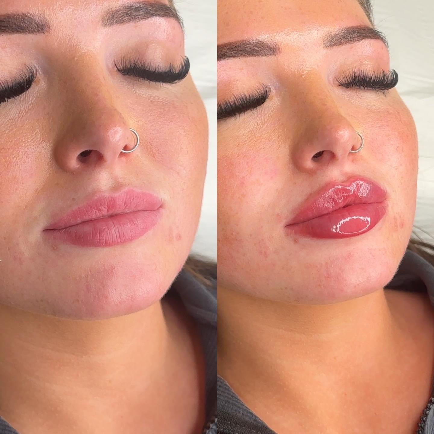 Ultimate Lips Masterclass - (Accredited)