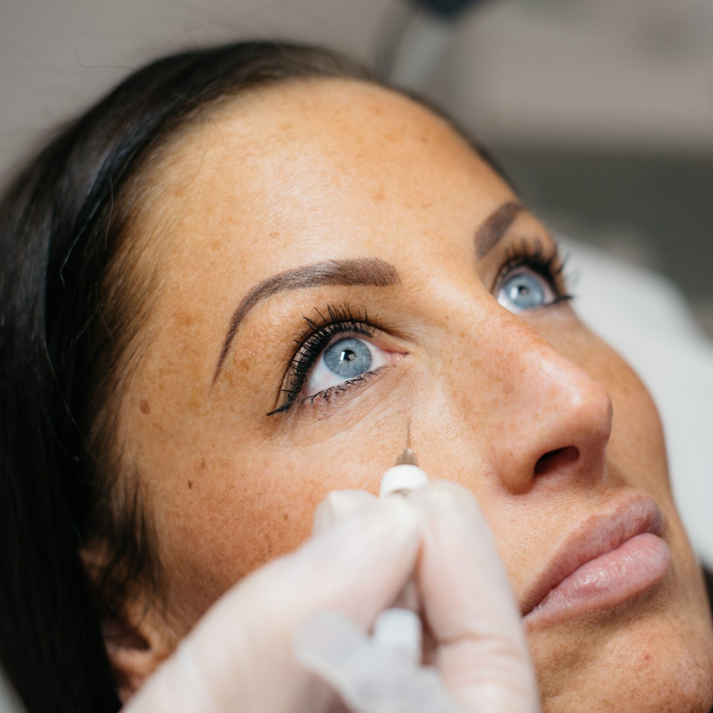 INHOUSE - Tear Trough Masterclass