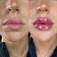 Ultimate Lips Masterclass - (Accredited)