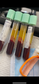 Phlebotomy, PRP & Vampire Facial Course