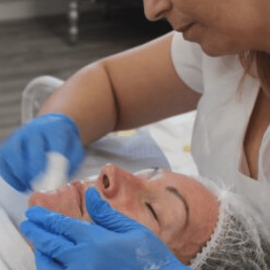 Online Chemical Peel Online Training Course - INCLUDES KIT -  (Accredited)
