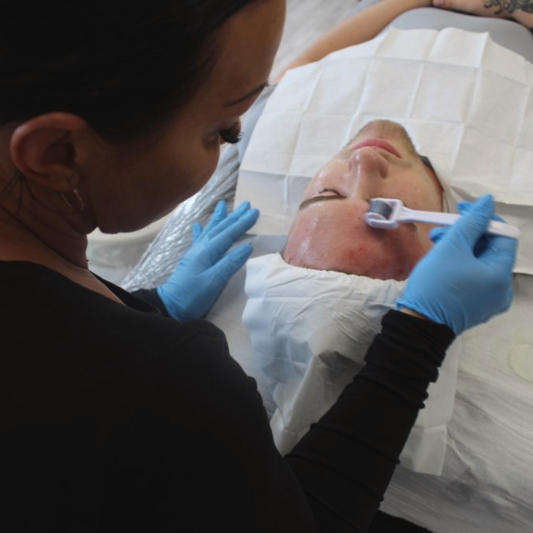 Online Skin Needling Training Course + NO KIT Accredited)