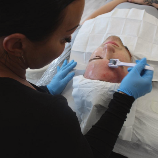 ONLINE - Skin Needling Training Course (WITH NO KIT)