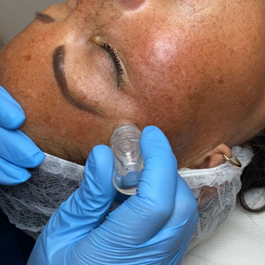 Online Cosmetox Facial (Btox Facial & Mesotox) - (Accredited)