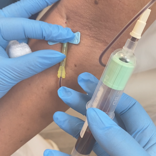 Phlebotomy, PRP & Vampire Facial Course and include Fat Dissolving Course for Only £50 SAVE £450 (Accredited)